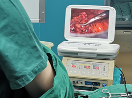 腹腔镜疝气手术应用案例