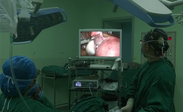 腹腔镜系统胆囊切除术操作步骤