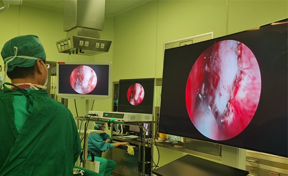 在神经外科，应该如何选择内窥镜摄像系统？
